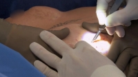 Botched S06E09 WEB x264-FLX [eztv]