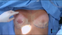 Botched S04E03 WEB x264-TBS[eztv]