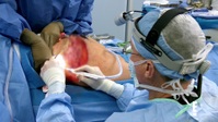 Botched S07E07 1080p HEVC x265-MeGusta EZTV Botched S07E07 1080p HEVC x265-MeGusta EZTV