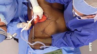 Botched S08E03 XviD-AFG EZTV Botched S08E03 XviD-AFG EZTV