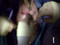 Botched S07E11 480p x264-mSD EZTV