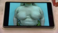 Botched S07E16 XviD-AFG EZTV Botched S07E16 XviD-AFG EZTV