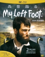 My Left Foot 1989 720p BluRay H264 BONE