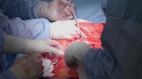 Botched Bariatrics S01E02 XviD-AFG EZTV Botched Bariatrics S01E02 XviD-AFG EZTV