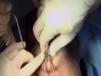 Botched S06E12 480p x264-mSD [eztv]