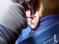 Botched S08E10 480p x264-mSD EZTV