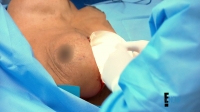 Botched S04E01 720p WEB x264-TBS[eztv]