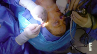 Botched S08E10 XviD-AFG EZTV Botched S08E10 XviD-AFG EZTV